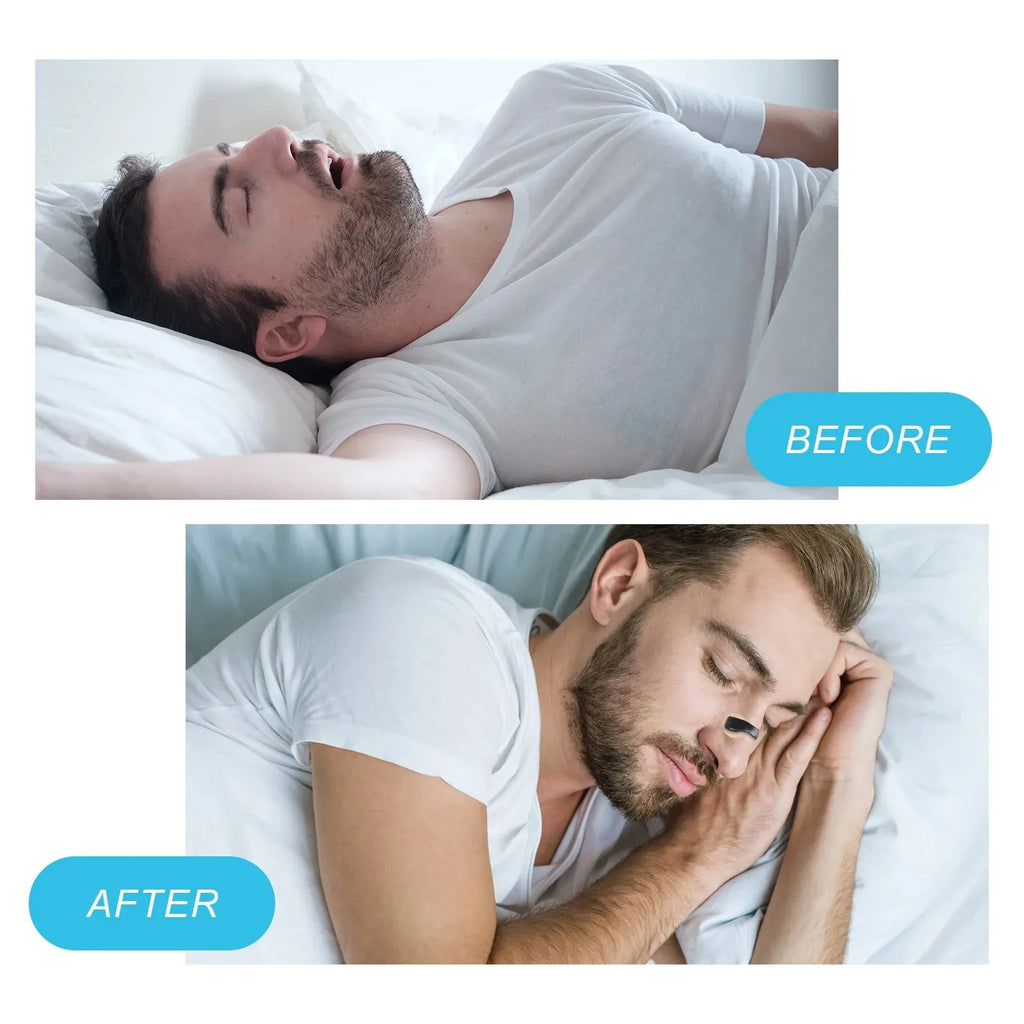 Magnetic Nose Strips Intake Breathing Anti-Snoring Nose Clip Nasal